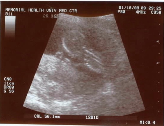 13-14 weeks 13-14 weeks